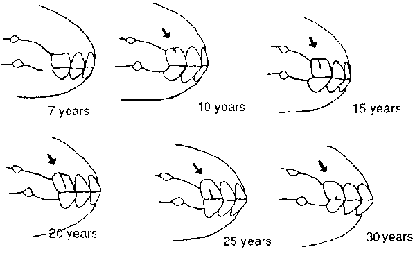 Equine teeth